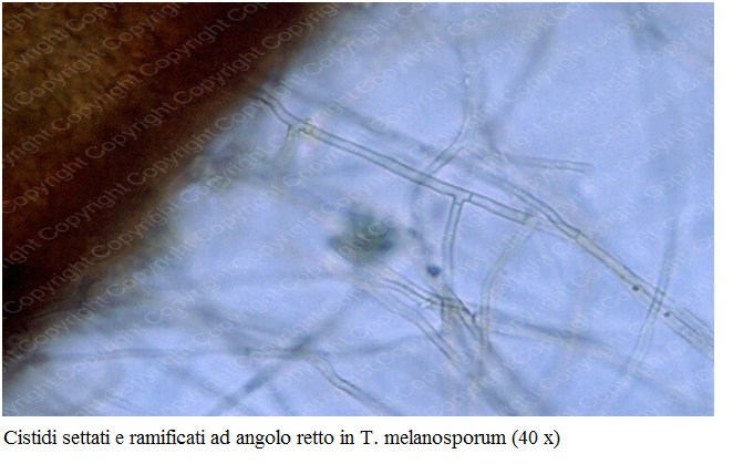 Cistidi in Tuber Melanosporum